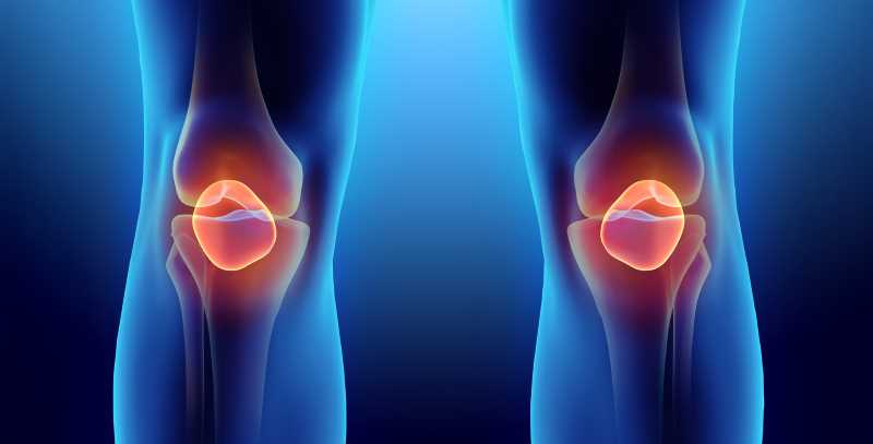 Osteoarthritis (OA) is a common joint disease that affects the cartilage cushioning the ends of bones in joints.  The UWL research review shows that simple strategies like focused exercises and adjusting certain aspects of the way we walk can help alleviate knee pain.