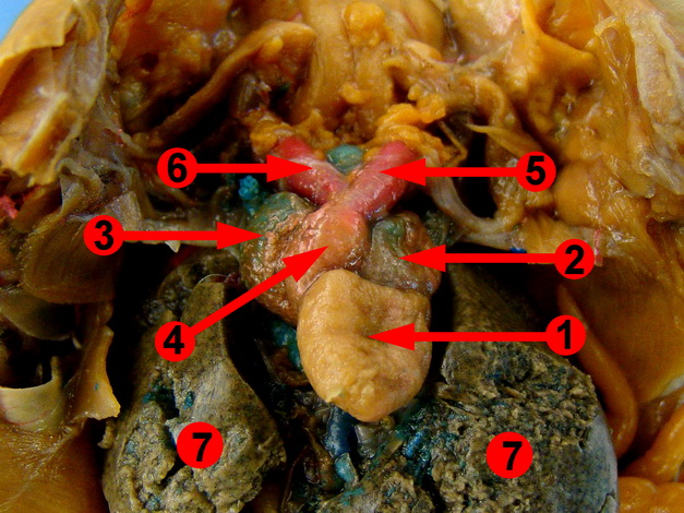 frog dissection heart