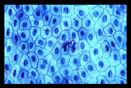 bone cells under a microscope
