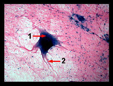 Skeletal Muscle Tissue Microscope Labeled