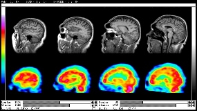 NMT MRI